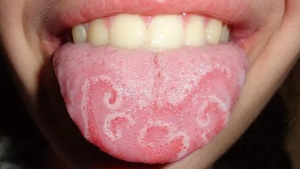 Lidah Geografis-1635998684