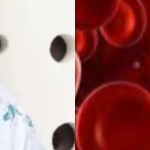 Anemia Aplastic-1712638132